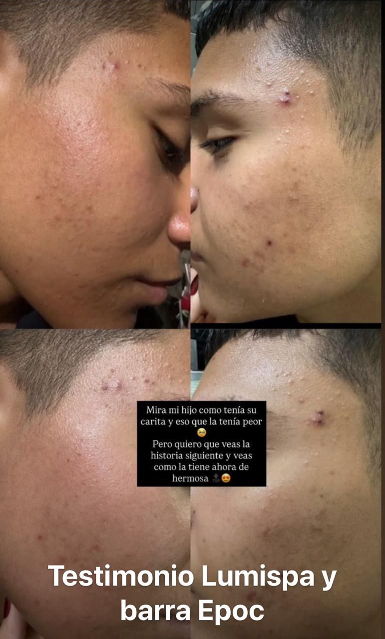 Antes y Después Polishing Bar