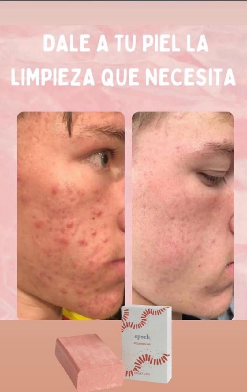 Antes y Después Exfoliante NuSkin