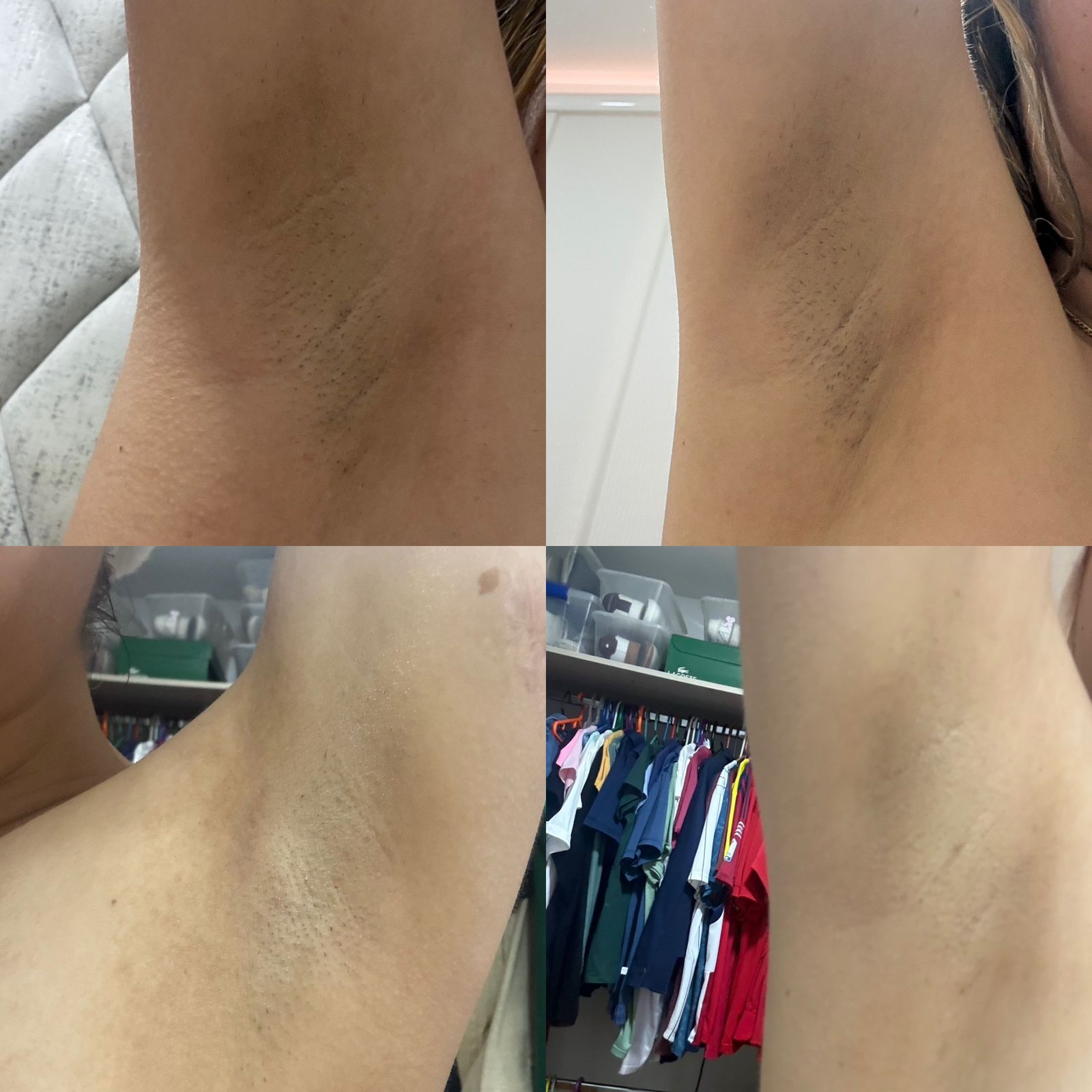 Polishing Bar NuSkin Resultados